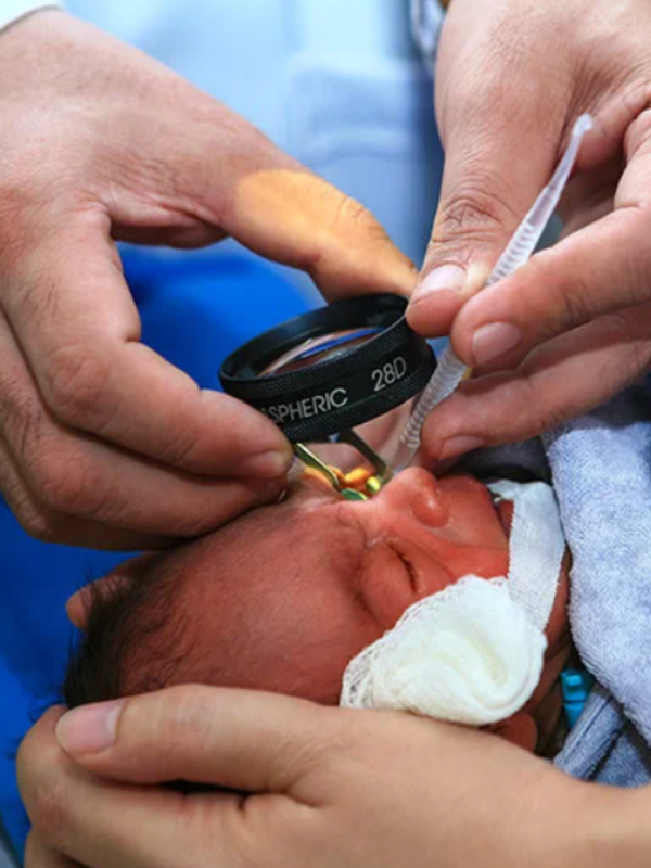 Retinopathy of prematurity screening and treatment